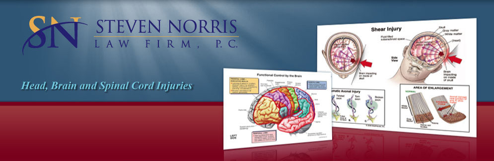 Brain and spine injury lawyer.